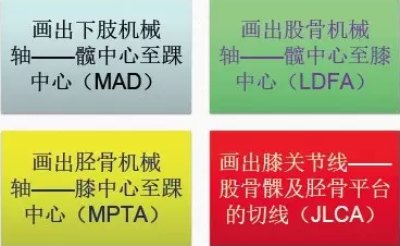 胫骨高位截骨术(HTO)治疗膝关节骨关节炎图片
