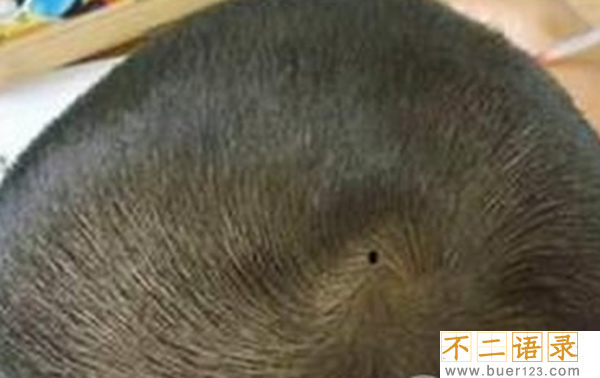男人哪里长痣最有福气,男人10处有痣是富贵痣图片