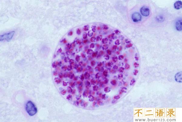 十大最恶心寄生虫 这十种虫子看了让人想吐（重口味）图片