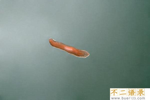 十大最恶心寄生虫 这十种虫子看了让人想吐（重口味）图片