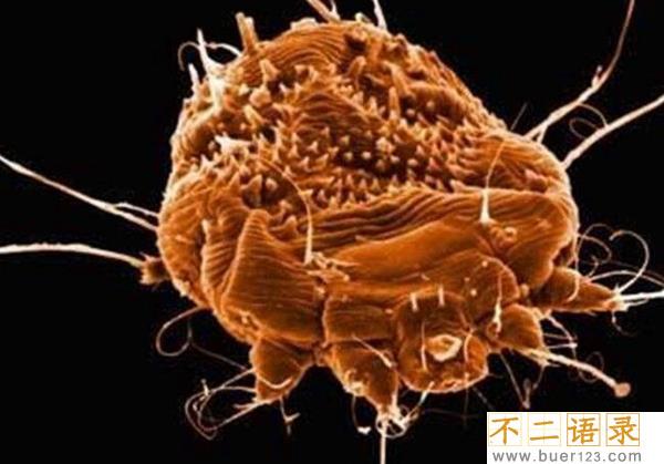 十大最恶心寄生虫 这十种虫子看了让人想吐（重口味）图片