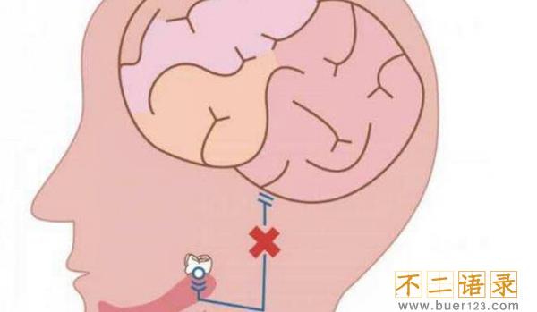 拔智齿后悔死了?这几种情况拔智齿会后悔(千万注意)图片