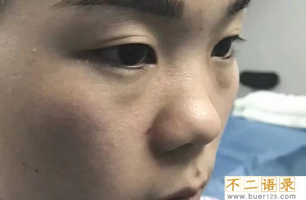 标准蒜头鼻荣华富贵：面相学中的真理，人们却不知真假