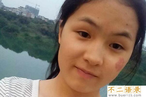 女人脸上有胎记好不好?要看胎记的位置才知道图片