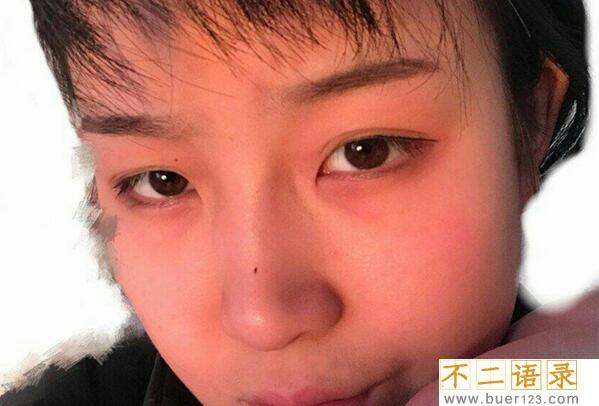痦子面相与命运图解：长在不同位置命运不同看看你是哪种图片