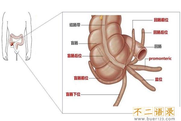 盲肠和阑尾是一回事吗?阑尾是盲肠的末尾(盲肠不能割)图片