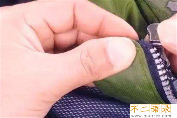 衣服拉链头掉了怎么办 修复拉链头的注意事项图片