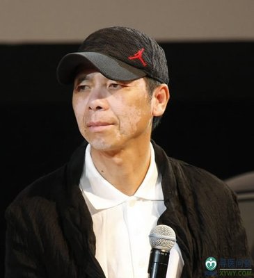 冯小刚白斑病严重吗能治好吗 冯小刚放弃生育原因曝光