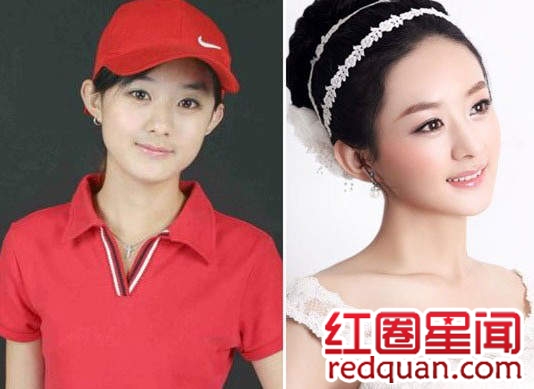 赵丽颖整容是真的假的 赵丽颖整容前后素颜照片变化惊人图片