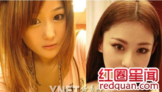 Baby素颜照曝光证实未整容 盘点遭整容质疑的当红女星_杨颖素颜吓死人图片