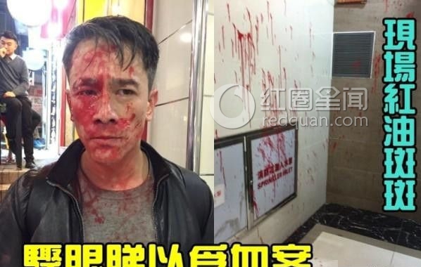 港星吴嘉龙遭人泼油漆 吴嘉龙究竟得罪了谁