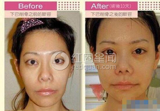 台湾女主持人斯容整容后漂亮吗 斯容整容前后大对比