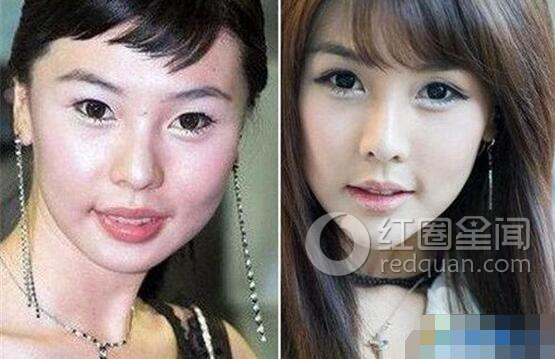 黄美姬被多少人玩过 黄美姬整容前后图片