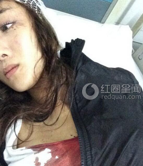 叶璇下降头是怎么回事 叶璇人品差大爆料图片
