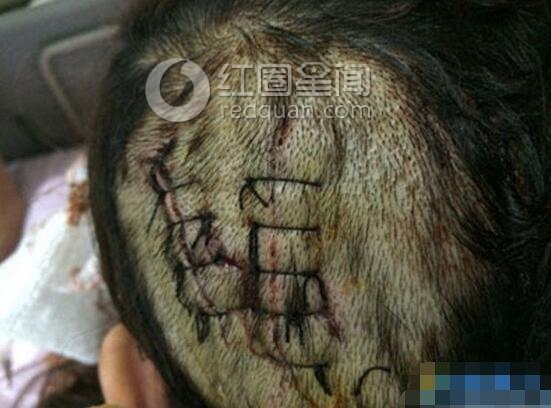 叶璇下降头是怎么回事 叶璇人品差大爆料图片
