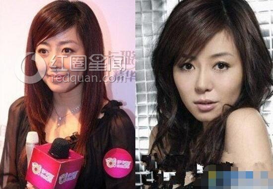 安又琪怎么消失 安又琪整容后是什么样子图片