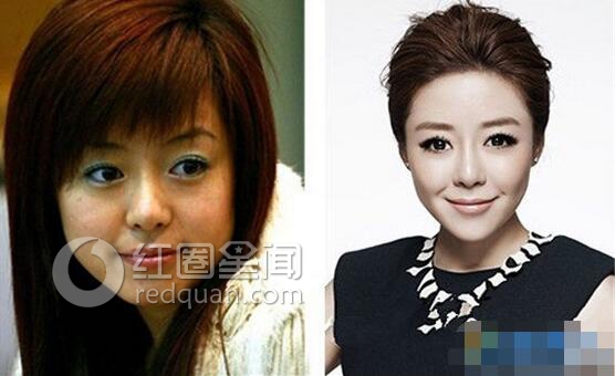 安又琪怎么消失 安又琪整容后是什么样子图片