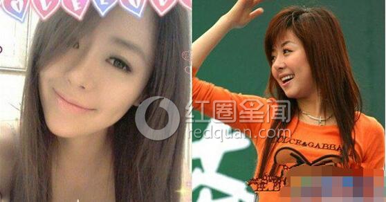 安又琪怎么消失 安又琪整容后是什么样子图片