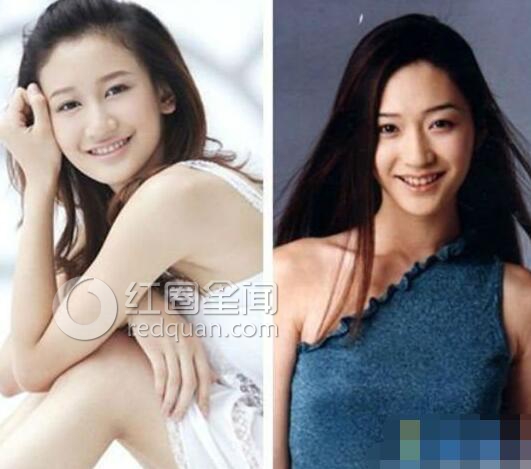 曾泳醍整容前后照片 为什么曾泳醍和李小冉好像图片