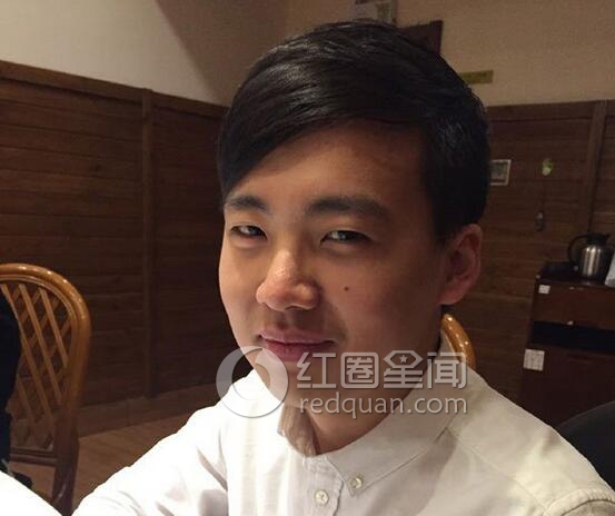 郭麒麟女友桃宝同台 郭麒麟减肥前后照片对比图片
