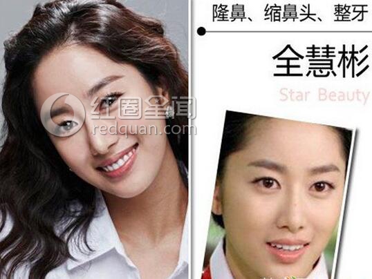 全慧彬整容了没有 全慧彬现任男友是谁