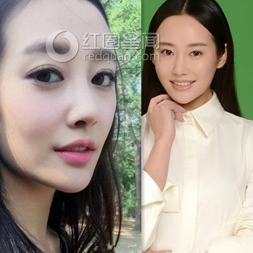 李纯整过容吗 李纯陈思诚什么关系