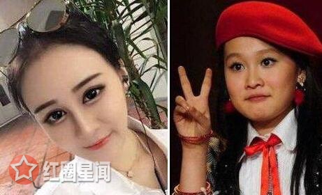 赵一涵整容之前什么样 赵一涵直播承认整容坦诚获赞