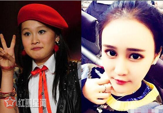 赵一涵整容之前什么样 赵一涵直播承认整容坦诚获赞图片