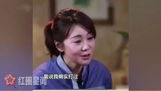 闫妮怎么变漂亮的 闫妮自曝打美容针变年轻没什么图片