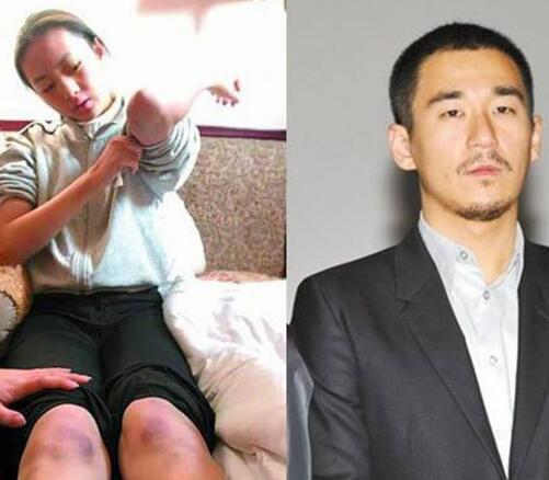 童瑶被张默打是因为什么 两个人当年发生了什么事情图片