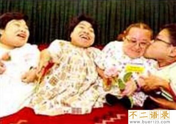 世界上最小的人排名，盘点世界十大袖珍人(最矮54.6厘米)图片