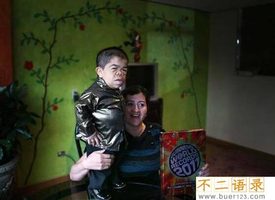世界上最小的人排名，盘点世界十大袖珍人(最矮54.6厘米)图片