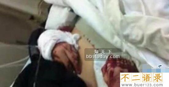 长春砍手门真相，死者吴天昊被砍断双手身亡(曾是恶霸)图片