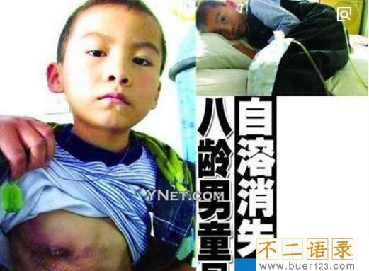 揭秘人体鬼怪骨之谜，世界罕见怪病(身体骨头被恶魔吃掉)图片