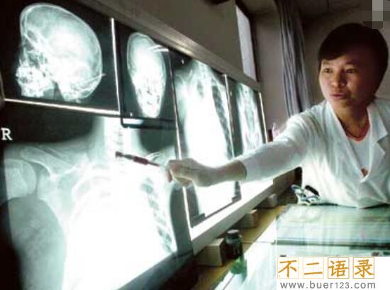 揭秘人体鬼怪骨之谜，世界罕见怪病(身体骨头被恶魔吃掉)图片