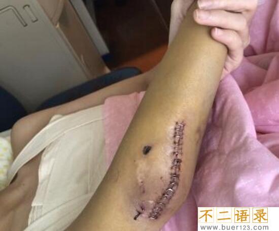 yy夏可可车祸事件经过，主播秦始皇伤重不治身亡(照片)图片