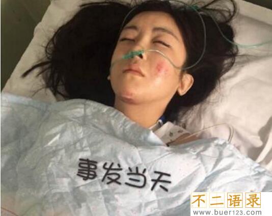 yy夏可可车祸事件经过，主播秦始皇伤重不治身亡(照片)图片