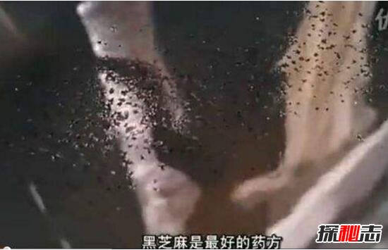 超恶心芝麻女孩的故事，芝麻镶进毛孔用牙签挑(图片/慎点)图片