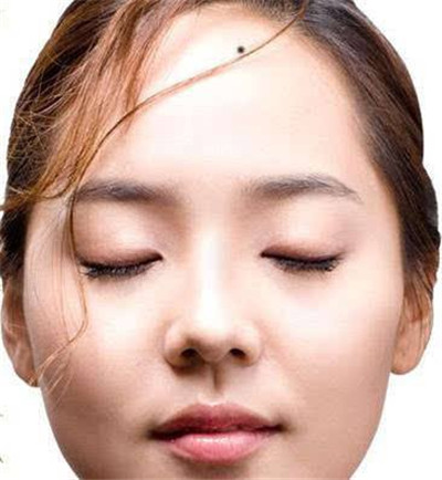 女人10处有痣是富贵痣图片