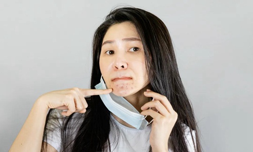 下巴长痘痘是什么原因 不想下巴反复长痘这样调理就对了图片